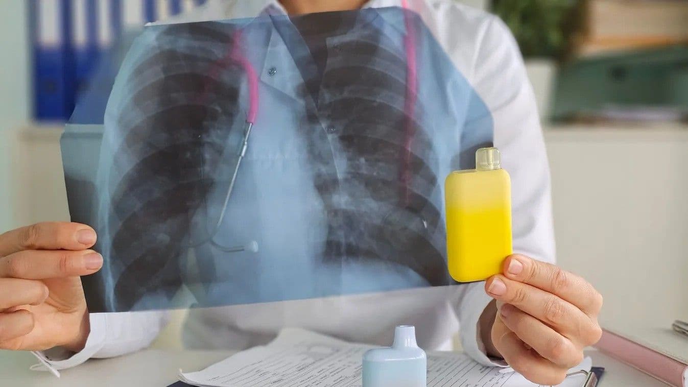E-cigitől omlott össze egy férfi tüdeje: "Úgy éreztem, mintha mellkason lőttek volna"