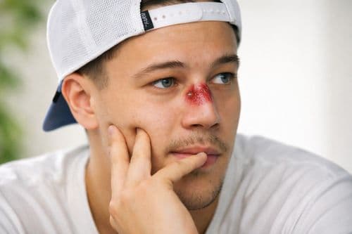 T. Danny orra körüli újabb botrány: a rajongók nem hisznek a szemüknek!